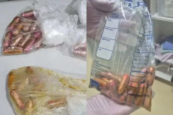 Boliviano é preso com drogas no intestino após reclamar de mal-estar